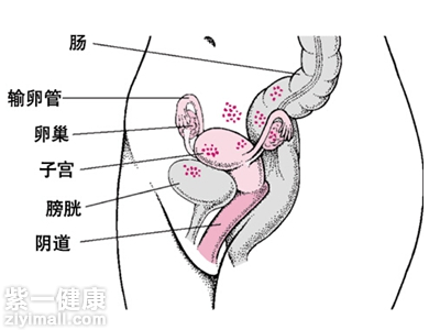 女性经期性生活的危害有哪些 5大危害不容忽视