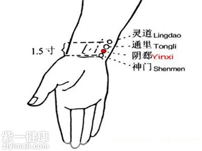 阴郄穴位位置图 可以跟哪些穴位搭配