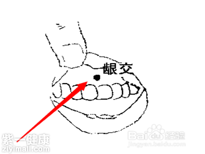 龈交穴位治疗痔疮的方法 两种方法帮你解决痔疮问题