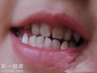 Сݷô 4շСݷ