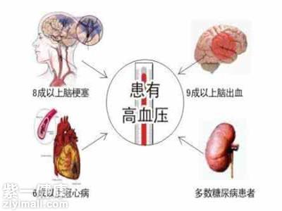 如何预防高血压脑出血 预防高血压脑出血的方法