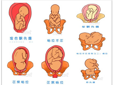 22种胎位图解图片