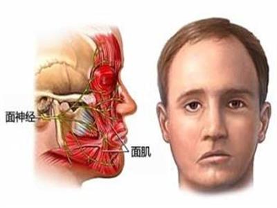 面部肌肉萎缩的原因有哪些 带您了解导致面部肌肉萎缩的因素