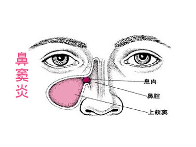 鼻窦区示意图图片