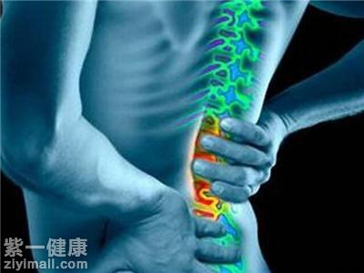 腰椎弯曲怎么矫正 三种方法缓解症状