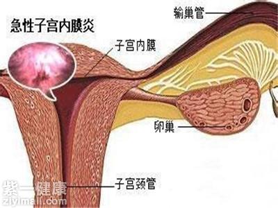 先天性生殖器官异常主要有子宫闭合,宫颈异常,阴道阻塞和输卵管畸形等