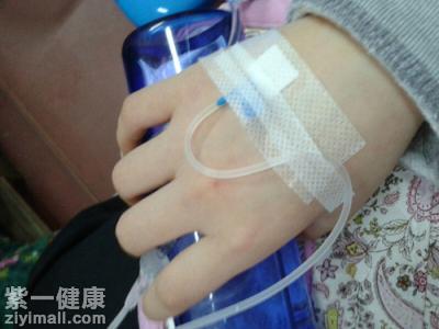 輸液後手腫了怎麼辦 教你四種小竅門解決這個問題