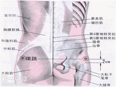 环跳穴疼痛的原因有哪些详解造成环跳穴疼痛的几大因素 紫一商城