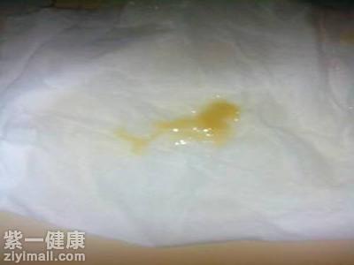 如何从痰的颜色判断病情 看痰的颜色揪出隐形“杀手”_紫一商城