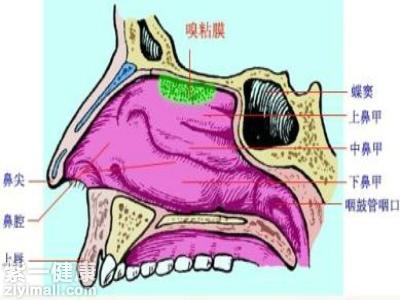 我們的鼻中隔偏曲的位置正好發生在了中鼻甲或者是下鼻甲的位置的話