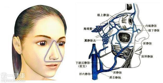 另外,面部有一个特别危险的三角区(见上图),通常指的是两侧口角至鼻根
