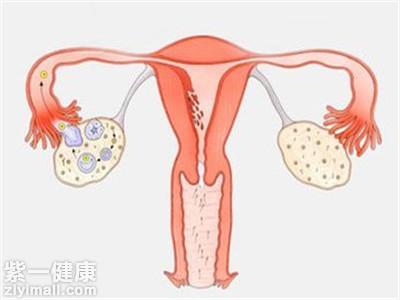 卵巢大小正常范围是多少揭示左右侧大小一致吗