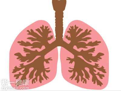 肺癌会遗传吗 肺癌会遗传吗
