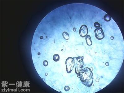 大腸桿菌對人體有害嗎瞭解大腸桿菌的四大預防方法