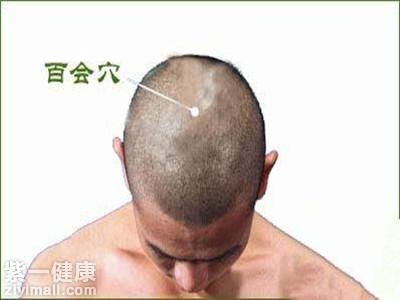 如何生发养发防脱发 按摩5个头部穴位有效生发