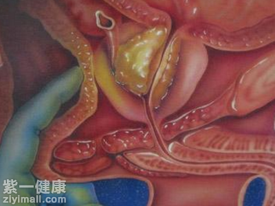 前列腺是男性生理活动中起着很重要的作用男人的前列腺部位是很重要的