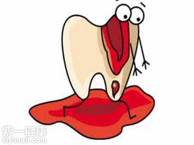 引起牙龈出血的原因有哪些 六大原因引发牙龈出血