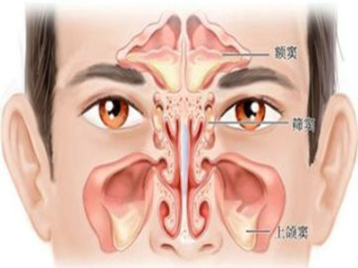 鼻咽炎图解图片