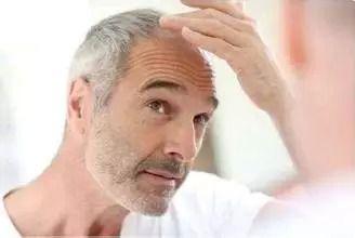 白头发怎么办 专家建议白头发不同原因不同疗法