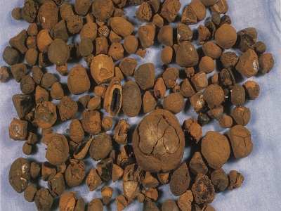 1,青礞石有很好的坠痰下气的作用,同时又可以平肝定惊,还有很好的消食