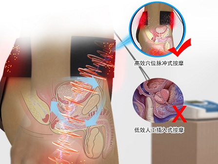 前列腺增生按摩示意图图片